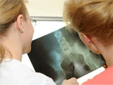 Kidney Failure